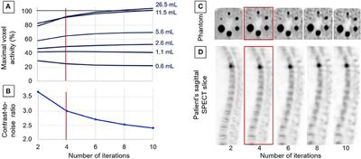 Bone Scintigraphy of Vertebral Fractures With a Whole-Body CZT Camera in a PET-Like Utilization
